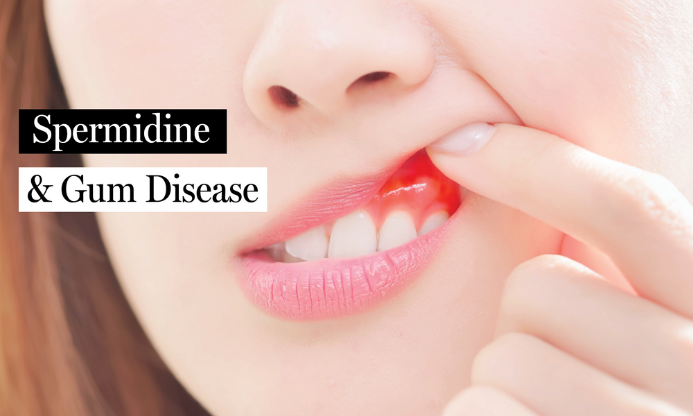 How Spermidine Can Help Treat Diabetic Periodontitis