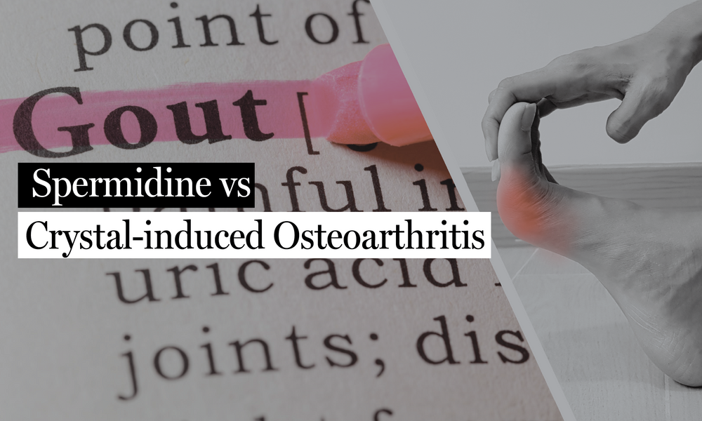 New Research: Spermidine Shows Promise in Fighting Crystal-Induced Arthritis