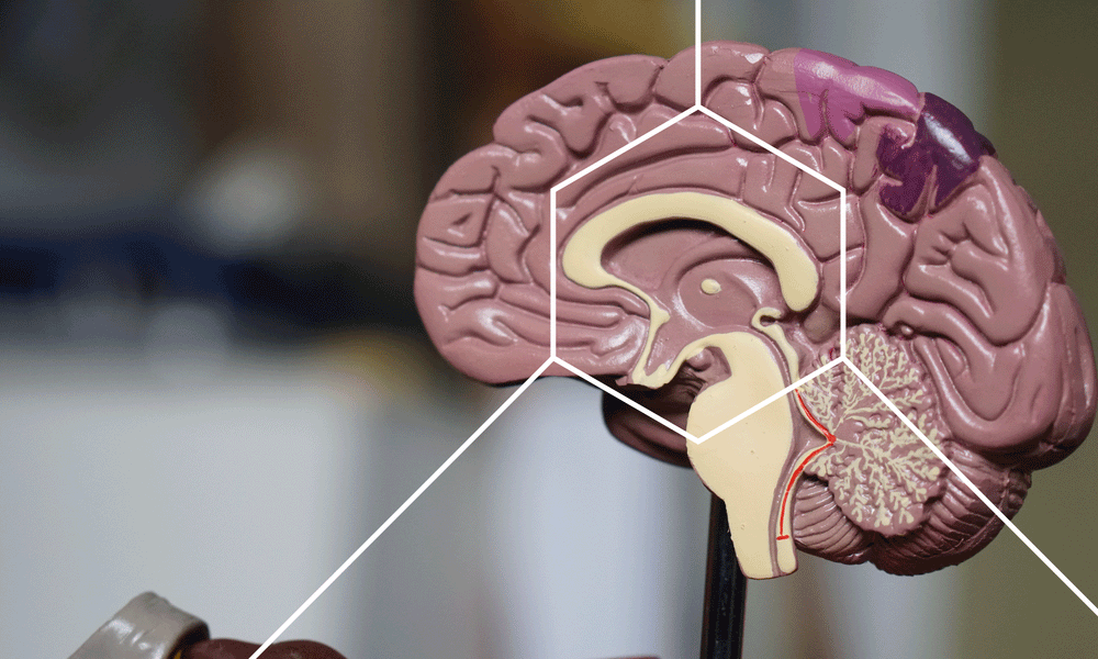 Model of a brain cut in half to show brain cell health