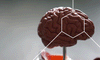 Model of a brain depicting long term brain injuries